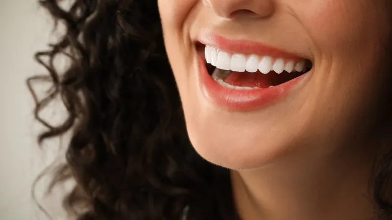 Dental Veneers abroad  – Intro Visual