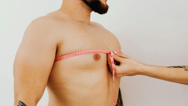  Gynecomastia Surgery