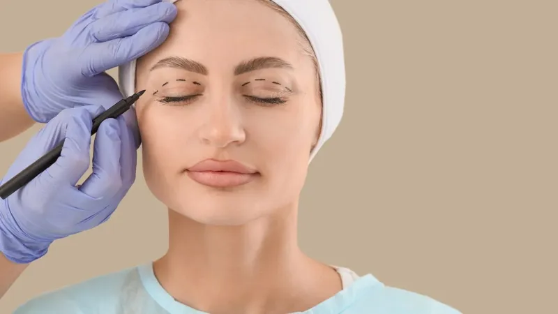 Blepharoplasty abroad  – Intro Visual