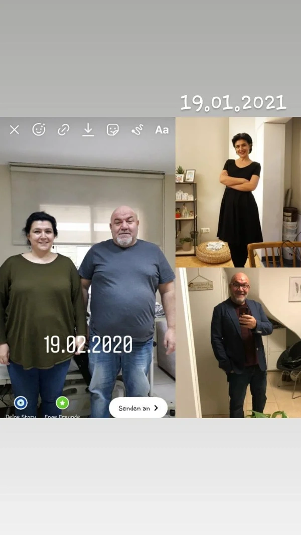 Ibrahim Karatas Schlauchmagen Op results in Turkey – case 301