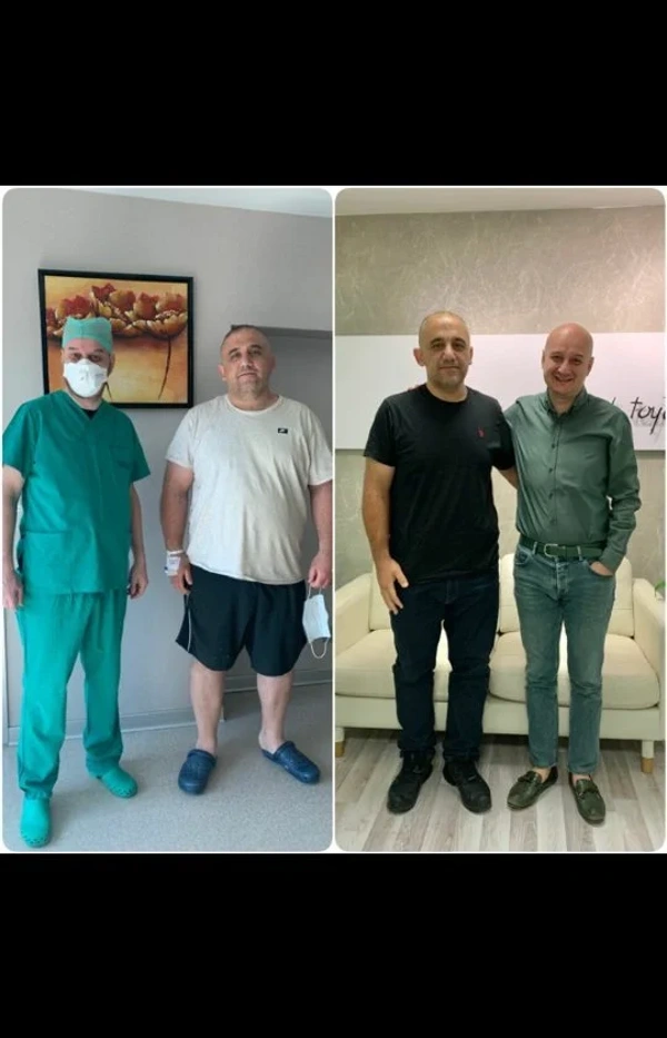 Toygar Toydemir Schlauchmagen Op results in Turkey – case 40