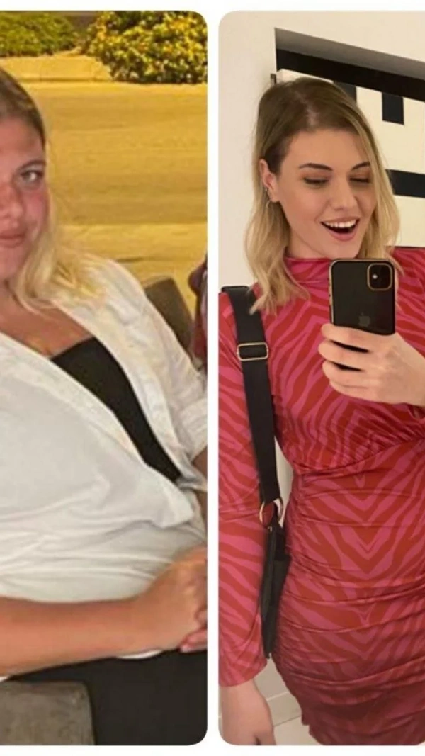 Toygar Toydemir Sleeve Gastrique results in Turkey – case 39