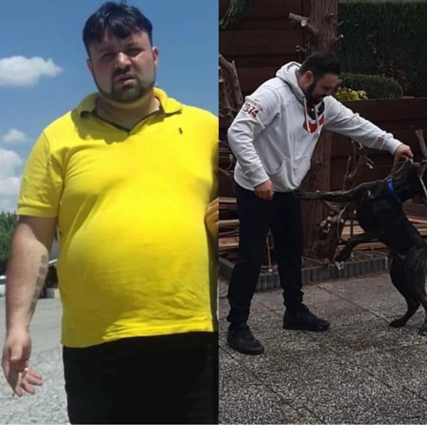 Ibrahim Karatas Maagballon results in Turkey – case 299