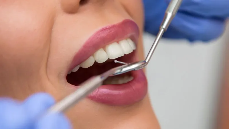 7 Beroemdheden met Tandheelkundige Implantaten