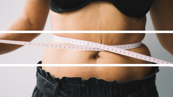  Tummy Tuck (Abdominoplasty)