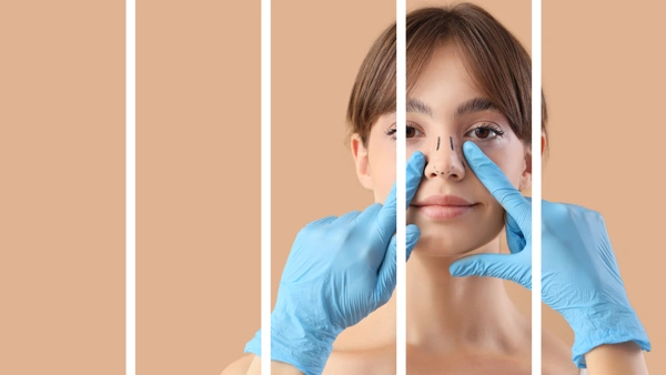  Rhinoplasty (Nose job)