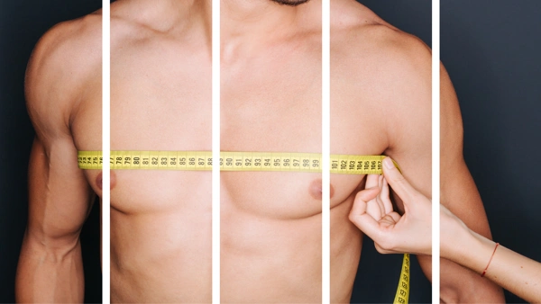  Gynecomastia Surgery