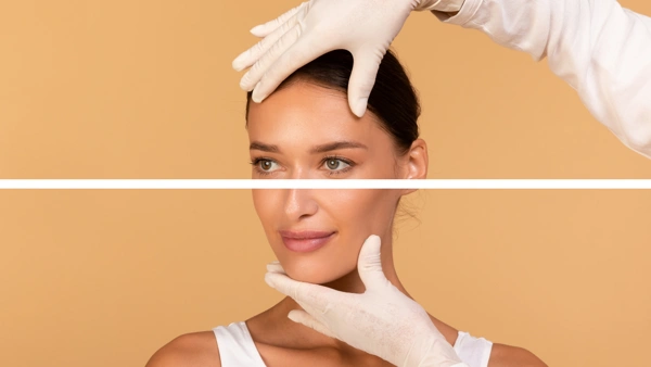  Facelift