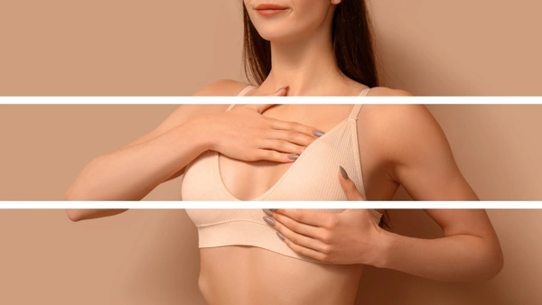  Breast Augmentation