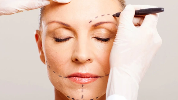 Blepharoplastik (Augenlidstraffung) kombiniert mit dem Verfahren 57 in Türkei