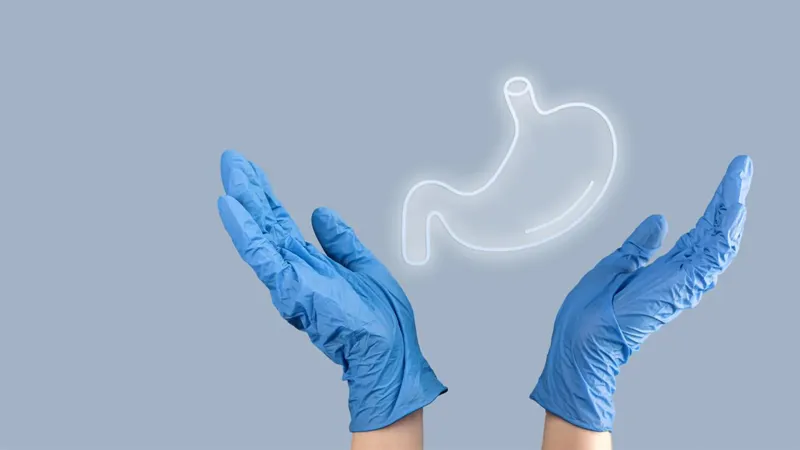 Gastric Sleeve 