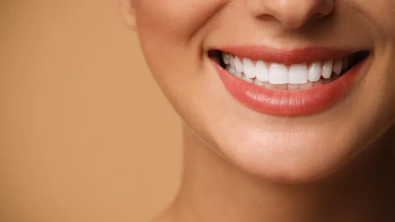 Dental Crowns