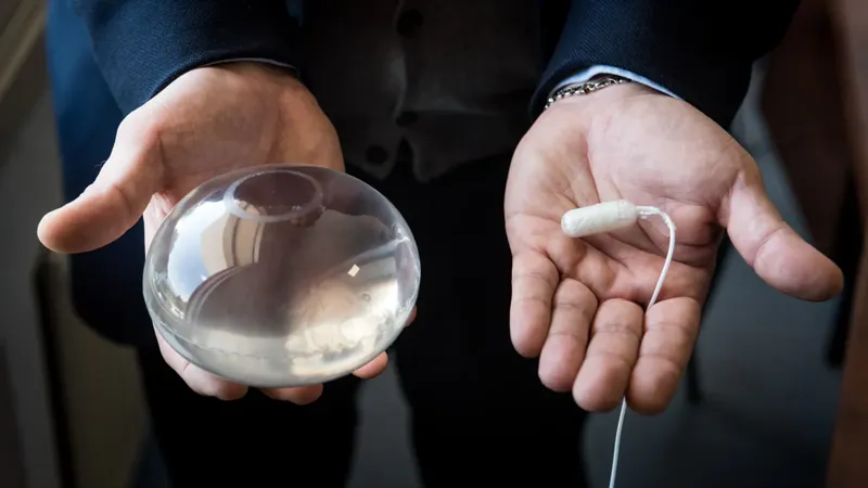 Gastric Balloon