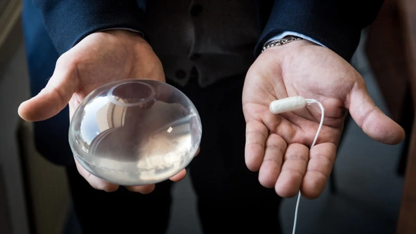 Maagballon gecombineerd met procedure 40 in Turkije